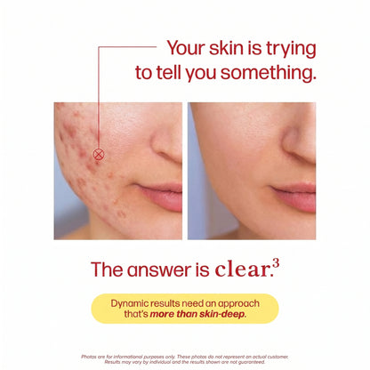 MagicElixir™ Clear Skin Capsules